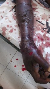 The young man who recently died in Voi from bad Antivenom.